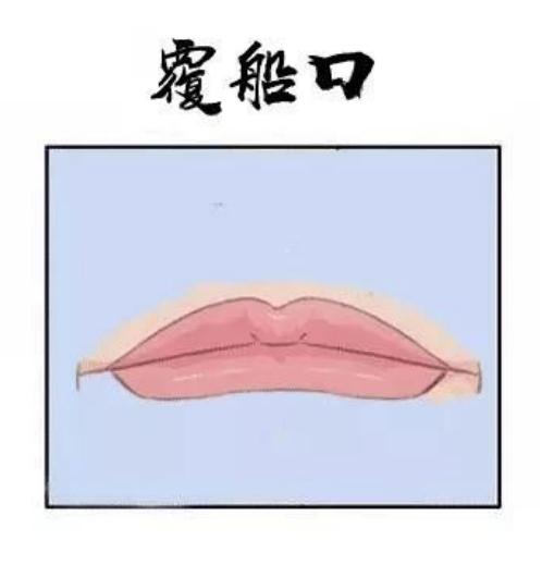 鲇鱼口面相图片解析