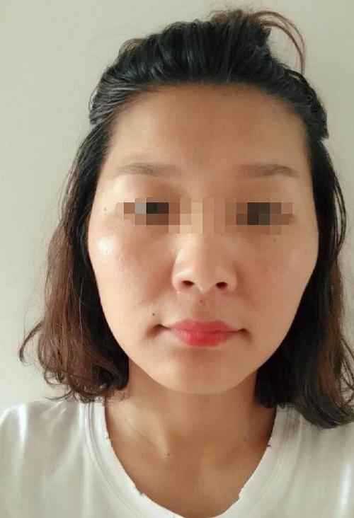 生活中容易产生自卑心理的面相