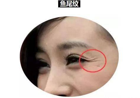 鱼尾纹算命看婚姻运势