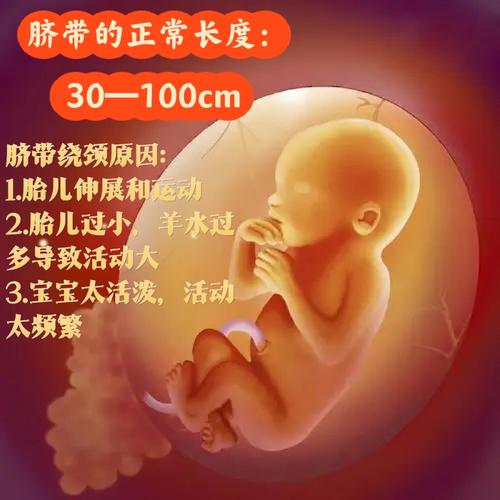 梦见脐带周公解梦,梦见脐带是什么意思?