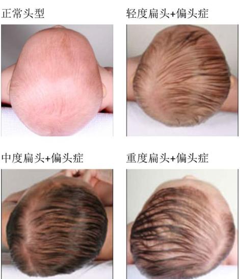 头尖额窄无贵格