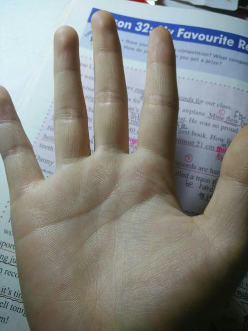 没有生命线的女孩子