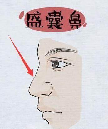 盛囊鼻