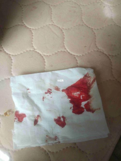 梦见例假来了好多血有什么征兆