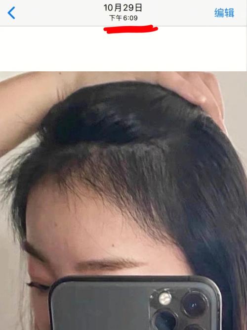发际线不整齐的男人性格非常自卑吗