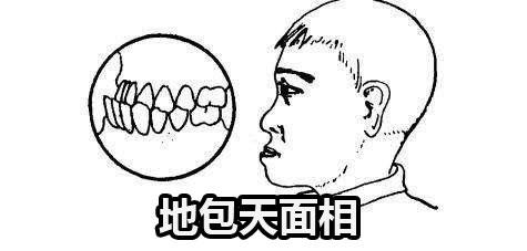 地包天面相的性格命运解析