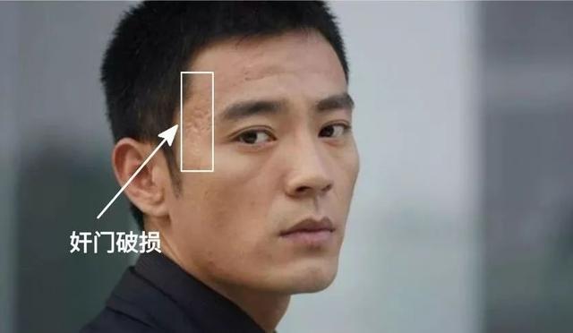 脸上的疤是否影响了你的面相