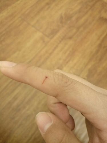 女人梦见狗咬伤了自己的手