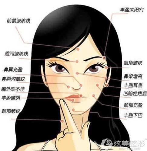 面部哪些部位不能整形?