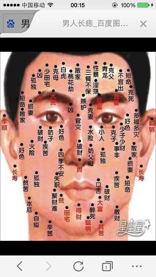 面相哪些痣可以点掉?可以点掉的面相痣解析