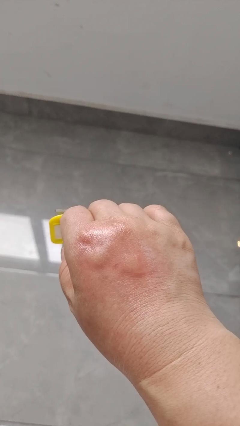 梦见手上长虫是什么意思