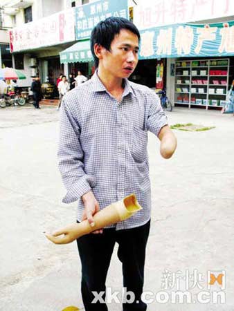 梦见自己的手被截肢是什么意思