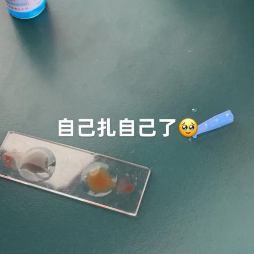 玻片法测血型步骤