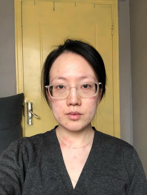 眉内颜色比脸色淡的人