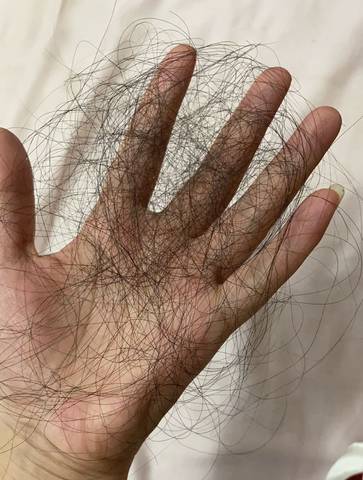 梦见自己一把一把的掉头发是什么意思