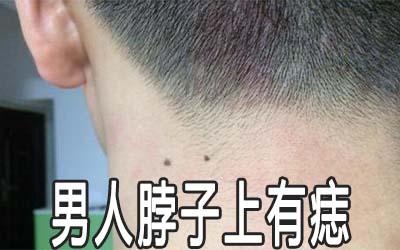 脖子左侧有痣的男人