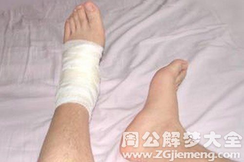 梦见脚伤筋 周公解梦之梦到脚伤筋