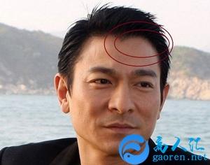 美人尖面相 美人尖面相男