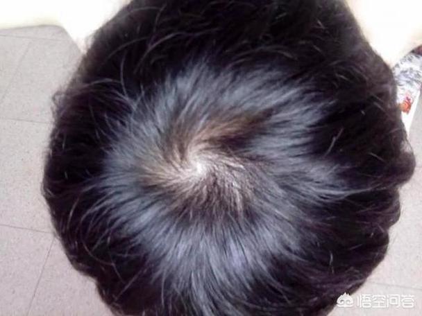 女头上两个旋命理说法好不好