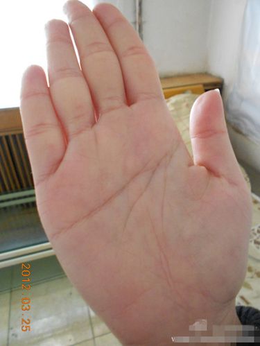 掌纹磨损变模糊对运势有什么影响