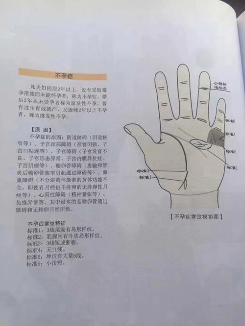 女人不孕的手相特征