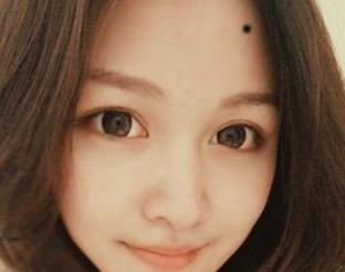 迁移宫有痣的女人面相