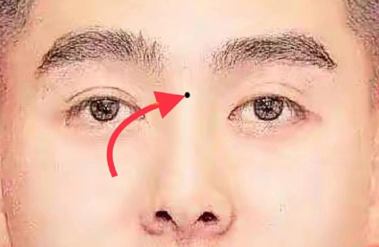 山根有痣的男人一定不好吗