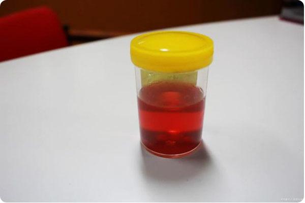 梦见酱油 梦见酱油色尿