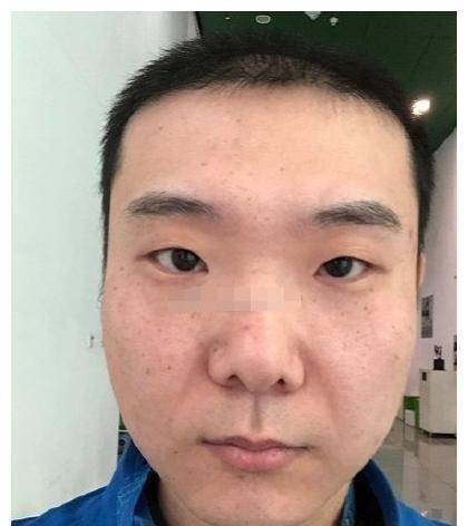 男人鼻梁歪什么预兆,一看就不是好人?