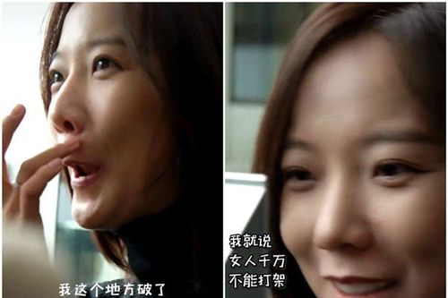 为什么说女孩破相命好
