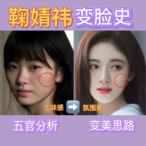 颧骨平而饱满的人桃花运出色吗