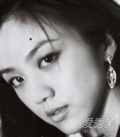 女人脸上的贵夫人痣