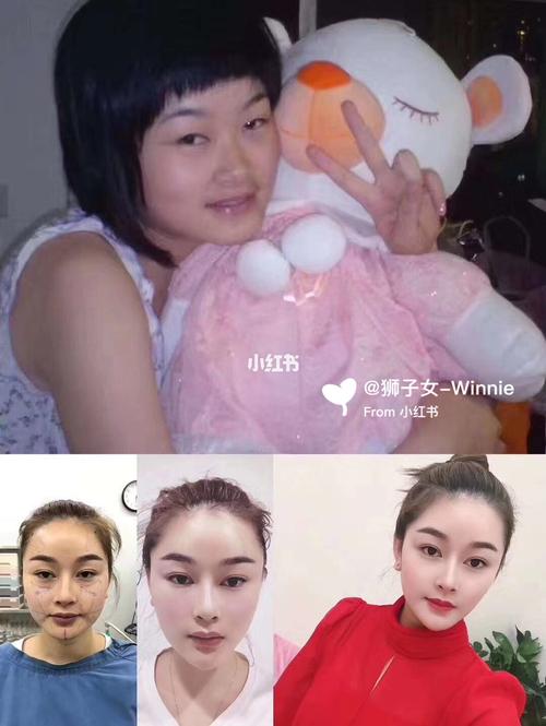 整容让你更漂亮更自信