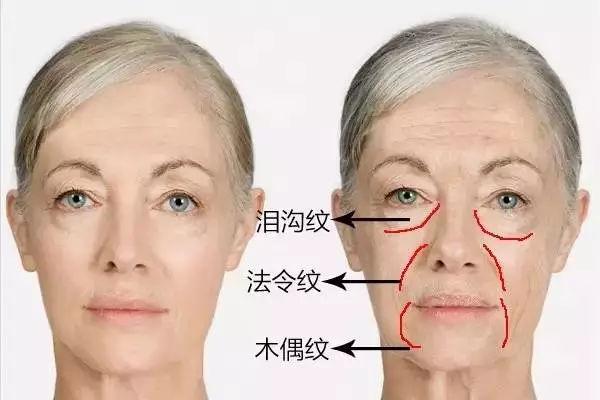 下巴皱纹很多的人是不是有暴力倾向