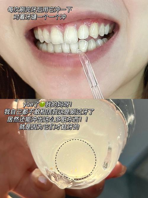 详解牙齿杂乱预示着什么