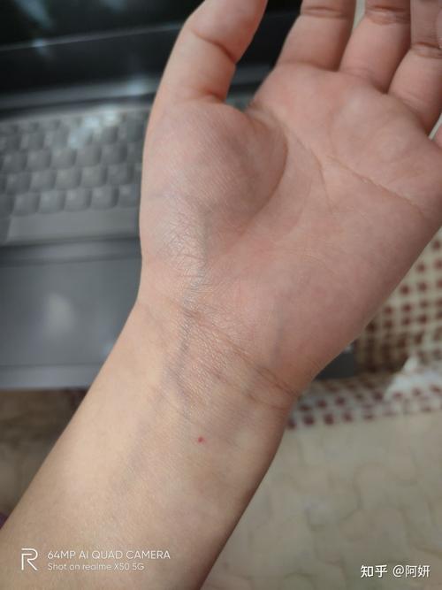 右手手腕有痣的女人命好吗