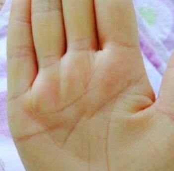 女人手掌太肥厚辛苦命是真的吗