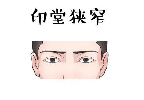 印堂窄有什么意义
