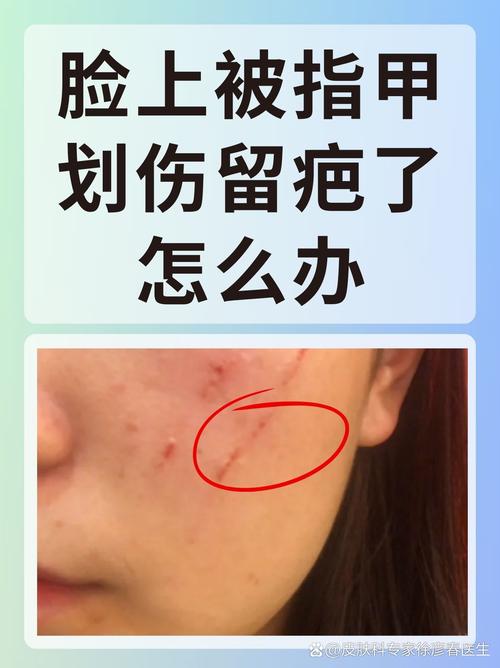 梦见脸被刀划