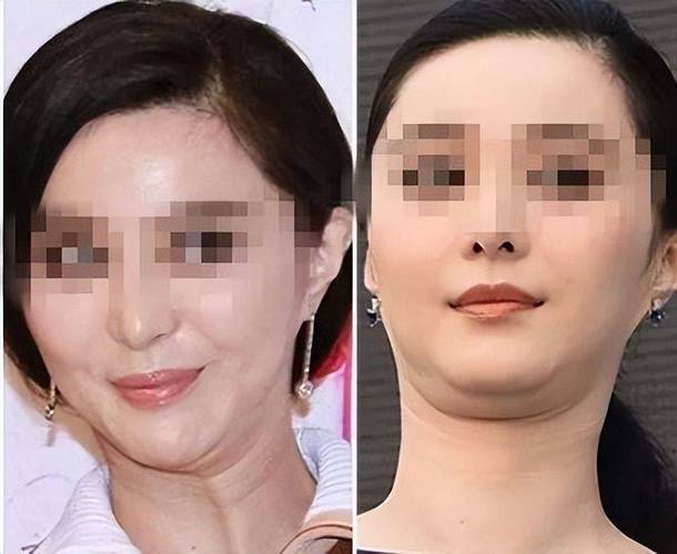 女人双下巴是好还是坏