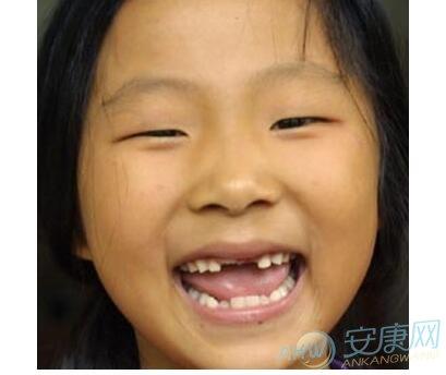 梦见小孩出牙