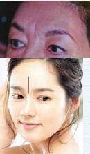 女人印堂有悬针纹会怎样