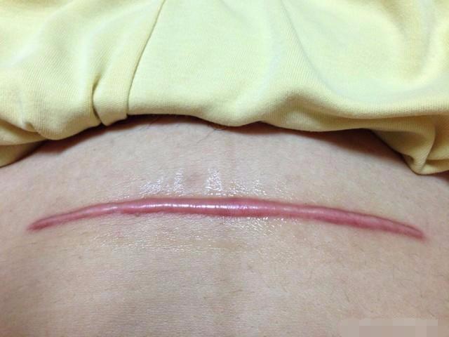 刨妇产远日子
