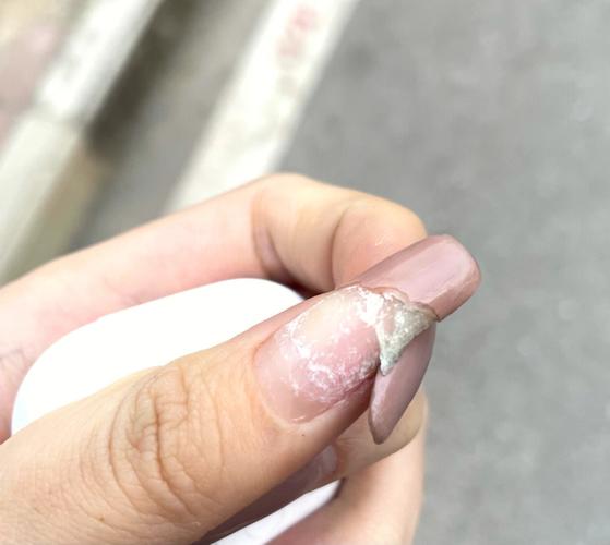 做梦梦到前男友手断了预示着什么