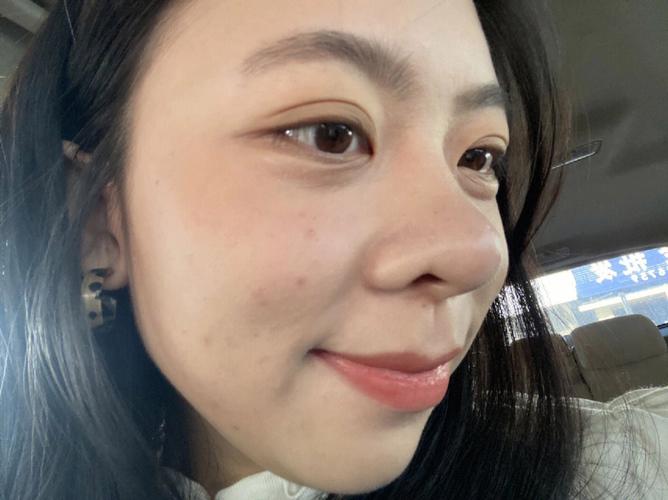 蒜头鼻的人多霉运吗