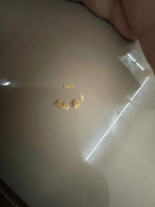梦见好多耳屎 周公解梦之梦到好多耳屎