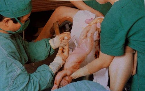 梦见别人生孩子全过程