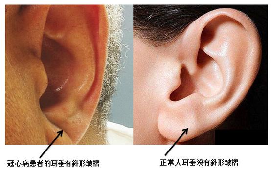 右耳朵发烫迷信说法