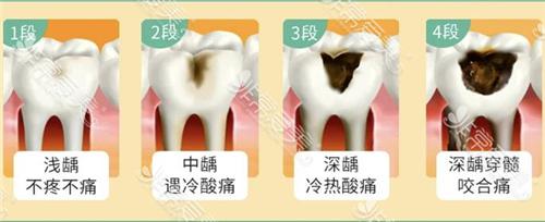 牙齿总坏身体缺什么吗