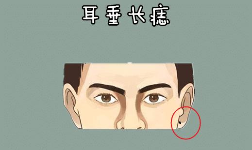 耳垂长痣的大富之人